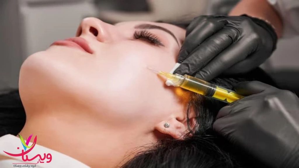 تزریق PRP به منظور جوانسازی پوست ناحیه فک و افزایش طراوت چهره تزریق پلاسمای غنی از پلاکت (PRP) برای جوانسازی پوست ناحیه فک و گونه