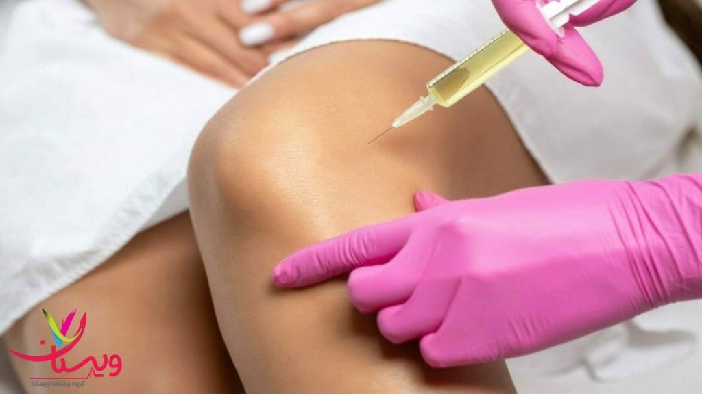 تزریق سلولهای بنیادی به مفصل زانو با رعایت اصول استریل