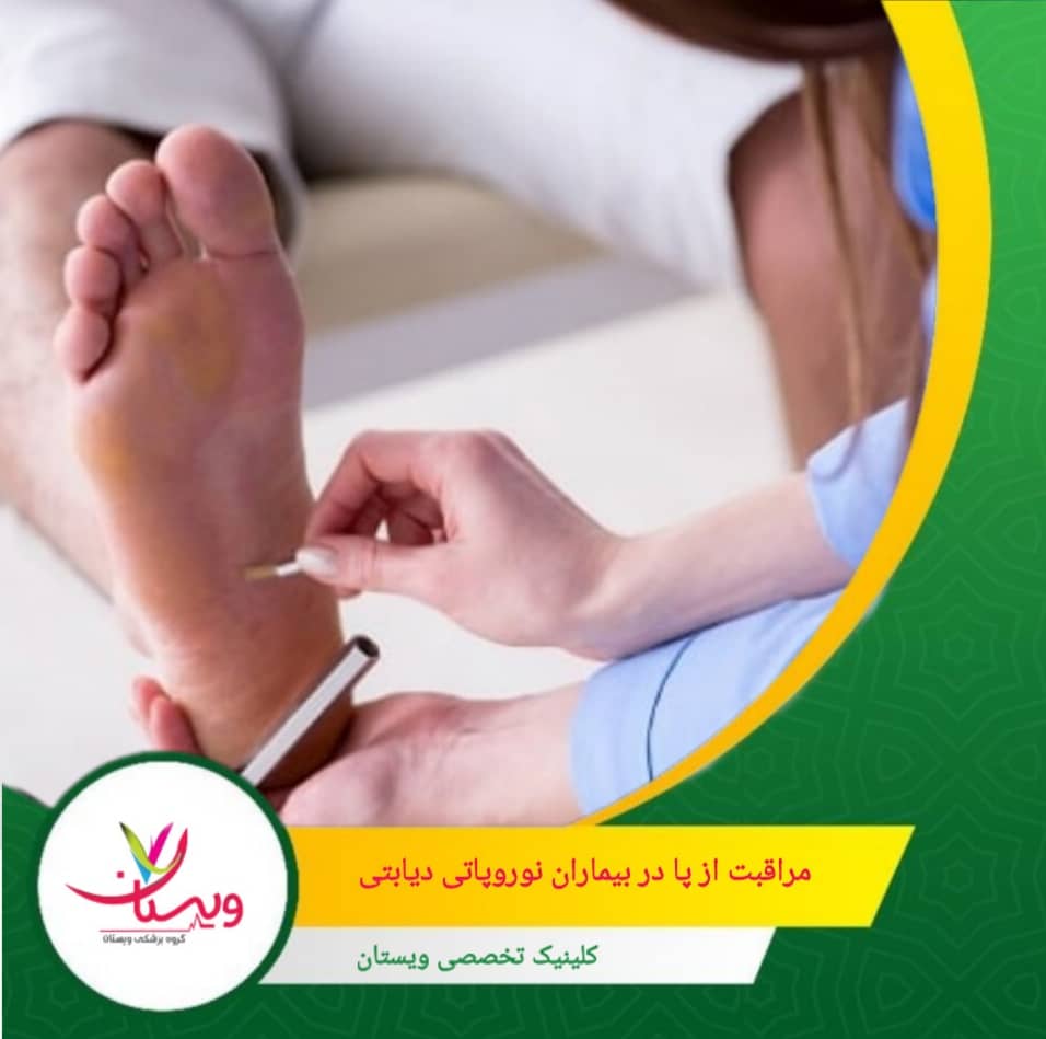 ناخنهای پا را صاف و کوتاه نگه دارید و از بریدن ناخن به شکل منحنی یا بسیار کوتاه خودداری کنید تا از ایجاد ناخنکج و زخم جلوگیری شود. مراقبت از پا در بیماران نوروپاتی دیابتی