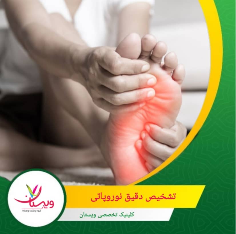 نرودیوگرافی (NCS/EMG) معمولاً در موارد پیچیده یا غیرمعمول استفاده میشود، نه بهصورت روتین در همه بیماران. تشخیص دقیق نوروپاتی