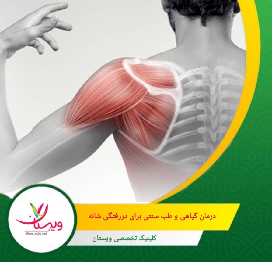 استفاده ترکیبی از درمانهای گیاهی همراه با مراقبتهای پزشکی و تمرینات توانبخشی، بهترین نتیجه را در بهبود دررفتگی شانه فراهم میکند. درمان گیاهی و طب سنتی برای دررفتگی شانه
