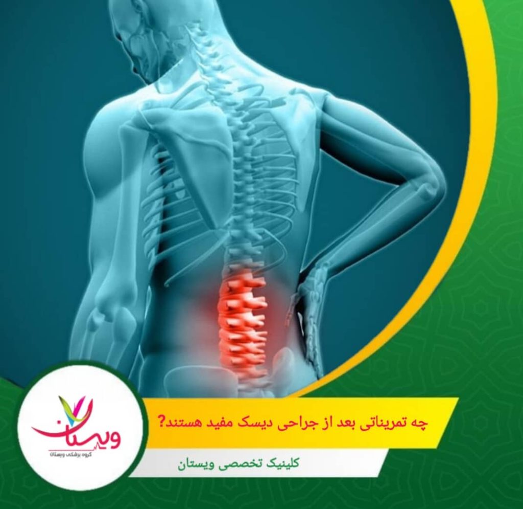 ورزش در آب میتواند فشار روی ستون فقرات را کاهش داده و در عین حال قدرت و انعطافپذیری را افزایش دهد. چه تمریناتی بعد از جراحی دیسک مفید هستند؟