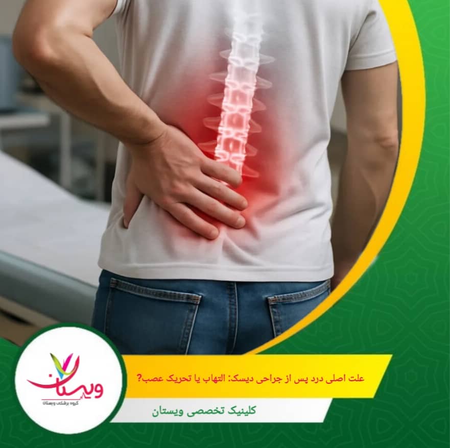 در مورد جراحی دیسک، این التهاب ممکن است باعث ایجاد درد، ورم و سفتی عضلات اطراف ستون فقرات شود. علت اصلی درد بعد از جراحی دیسک: التهاب یا تحریک عصب؟