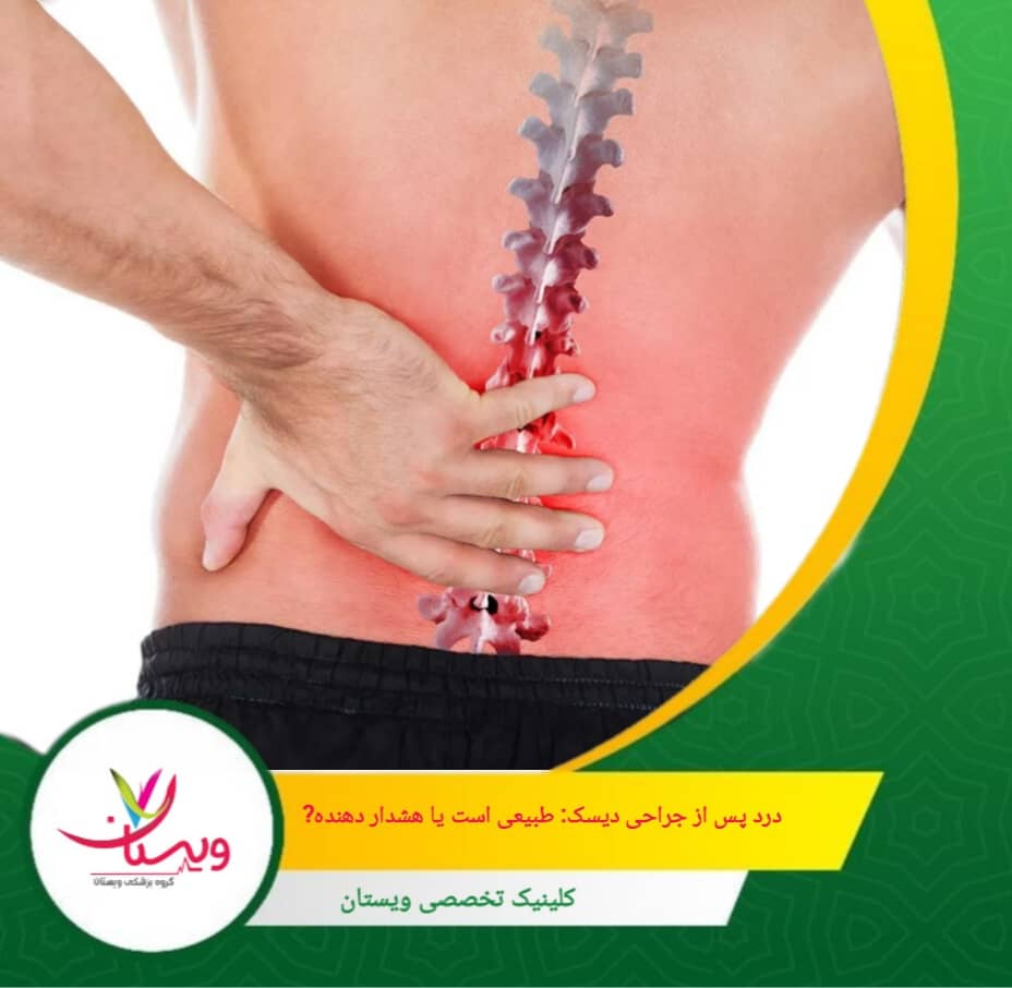 این درد در بیشتر موارد طی چند هفته کاهش مییابد و جای نگرانی ندارد. درد پس از جراحی دیسک: طبیعی است یا هشداردهنده؟