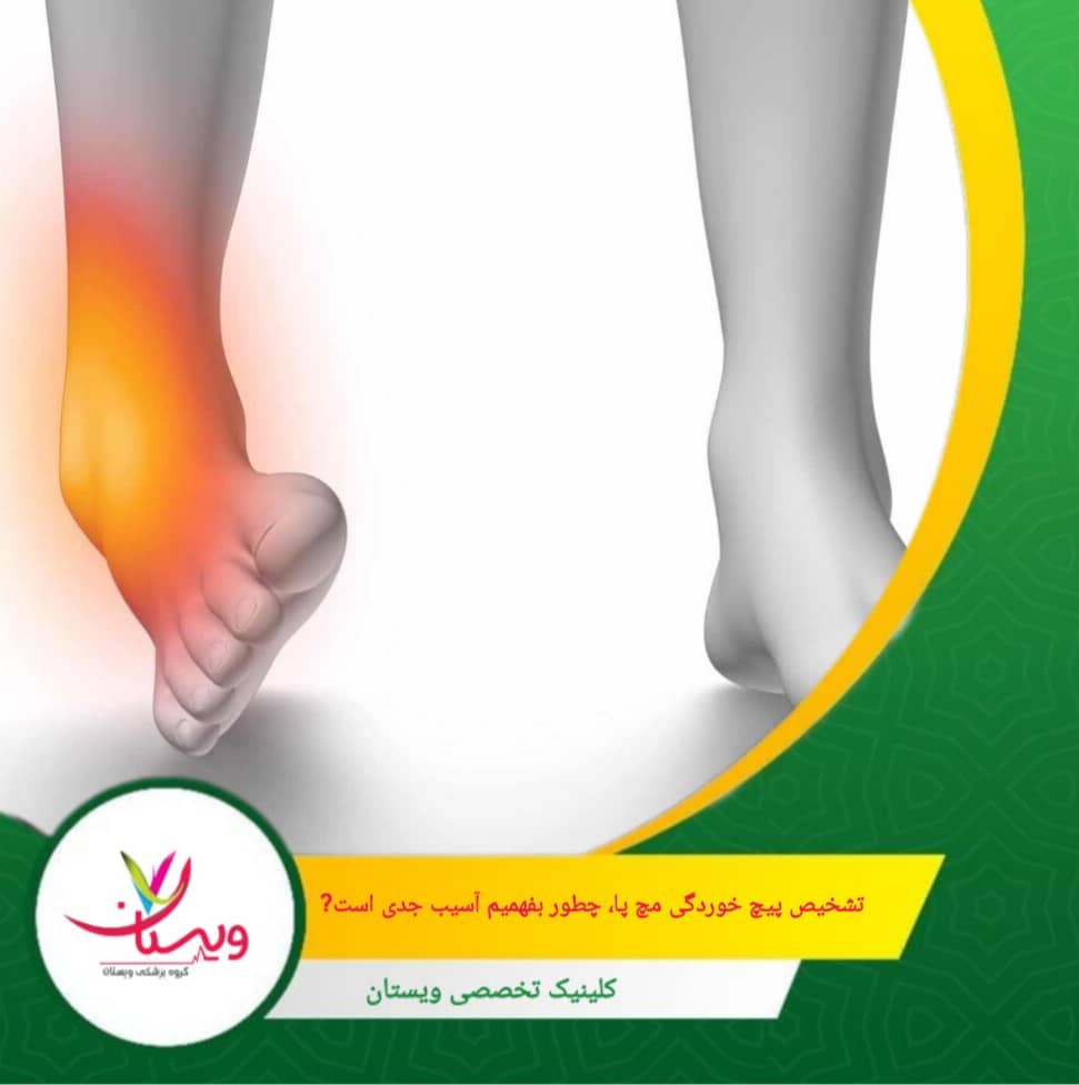 یکی از مهمترین شاخصها برای تشخیص شدت آسیب، توانایی راه رفتن است. اگر میتونید با کمی درد قدم بزنید، پیچخوردگی احتمالاً خفیف است. تشخیص پیچخوردگی مچ پا؛ چطور بفهمیم آسیب جدی است یا نه؟