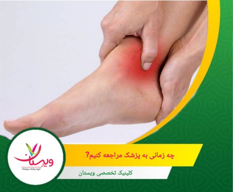 تورم زیاد و سریع که در عرض چند ساعت پس از آسیب رخ میدهد و باعث محدود شدن حرکت میشود. چه زمانی باید برای پیچخوردگی مچ پا به پزشک مراجعه کنیم؟