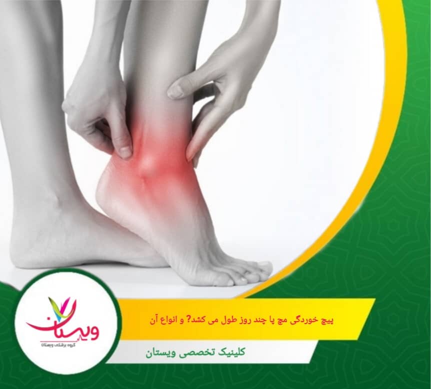 پارگی کامل لیگامان، درد شدید، تورم گسترده و بیثباتی محسوس مفصل. بازگشت کامل ممکن است چند ماه زمان ببرد، برخی منابع بازه ۳ تا ۶ ماه یا حتی بیشتر را گزارش کردهاند. پیچ خوردگی مچ پا چند روز طول میکشد؟ و انواع آن