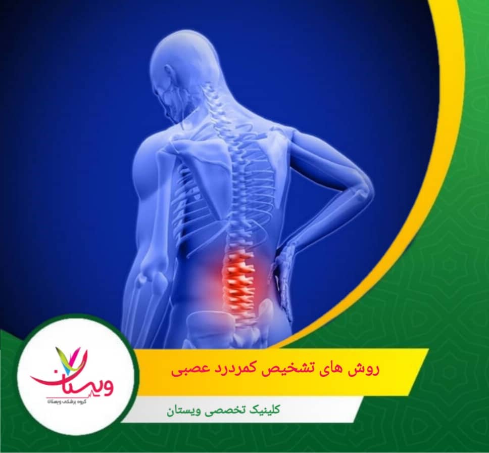 این آزمایش کمک میکند تا عملکرد عصبها و عضلات بررسی شود و میزان آسیب عصبی مشخص گردد. روشهای تشخیص کمردرد عصبی