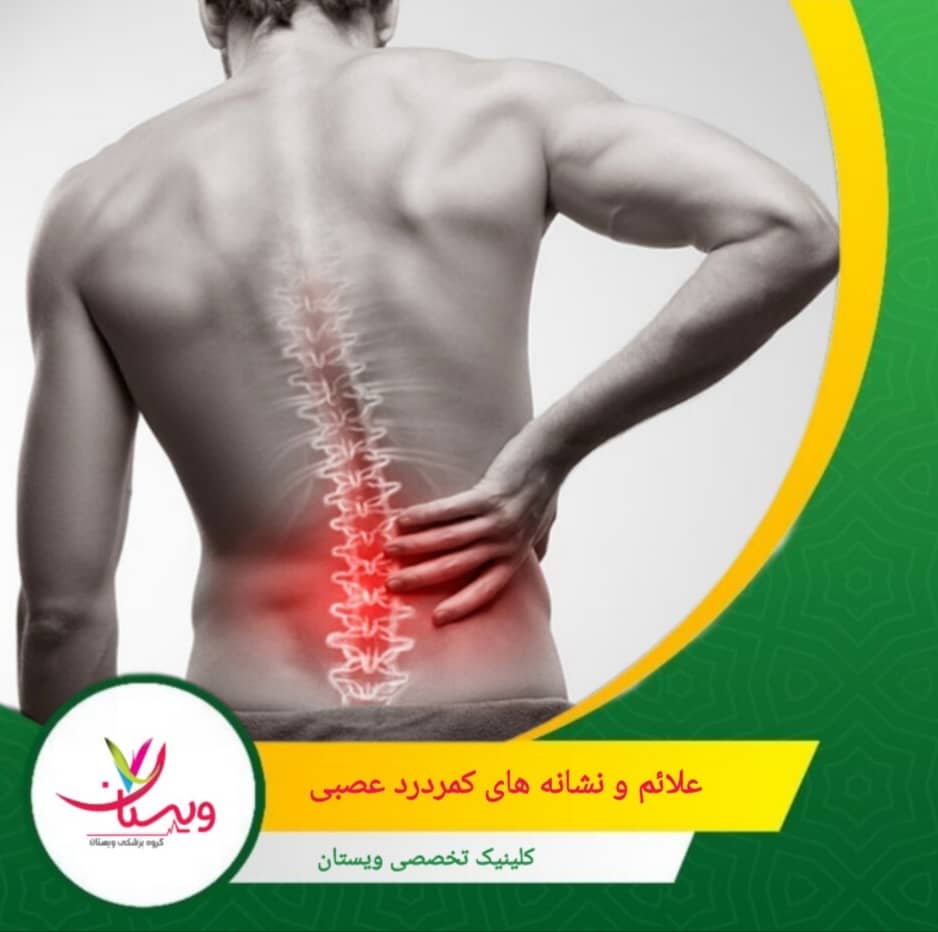 درد تیرکشنده یا سوزشی که از کمر به سمت پایین پاها (باسن، ران و ساق) منتشر میشود. علائم و نشانههای کمردرد عصبی