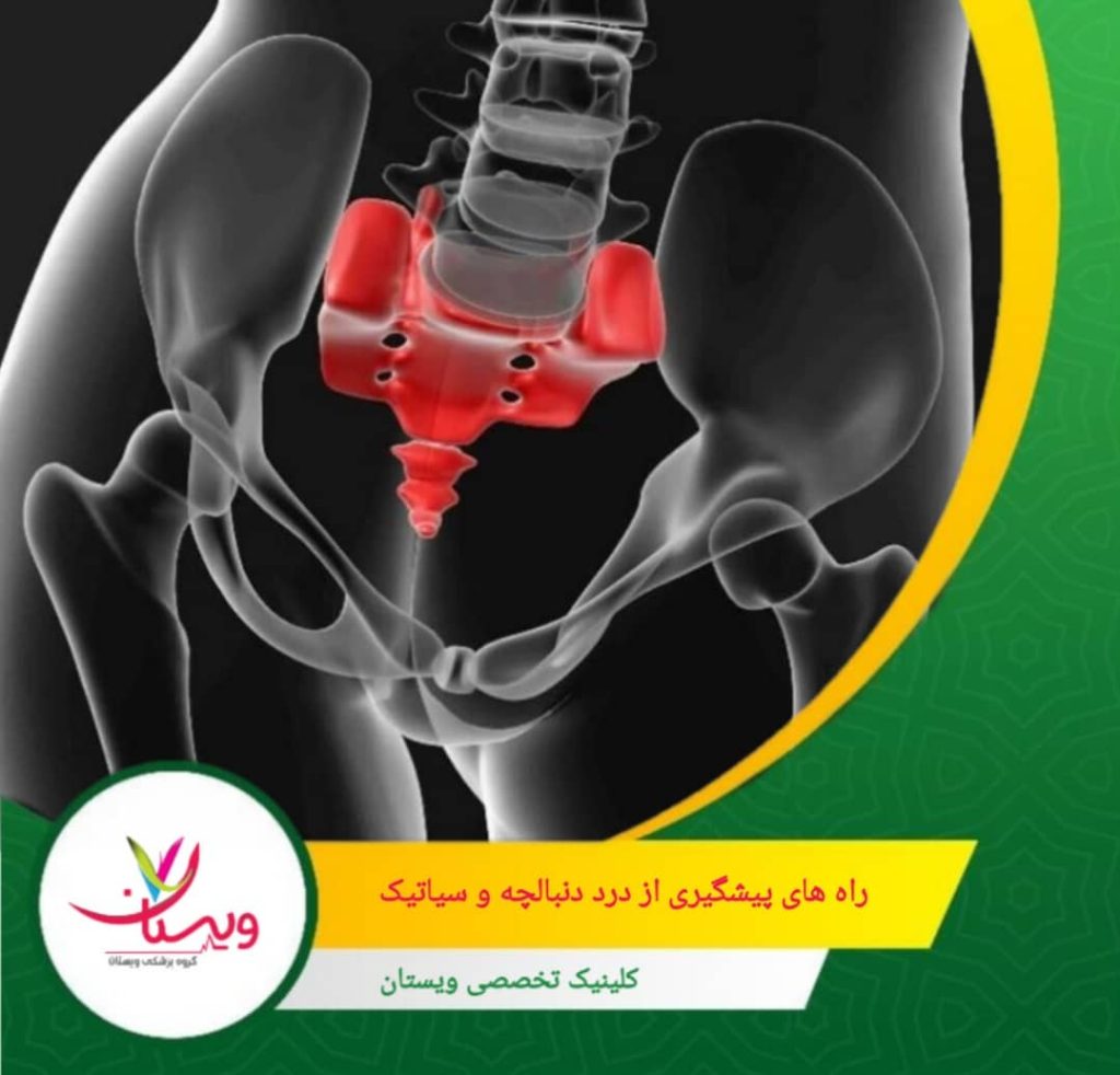 استرس مزمن میتواند باعث تشدید دردهای عضلانی شود، بنابراین رعایت تکنیکهای آرامسازی مفید است. راهکارهای پیشگیری از درد دنبالچه و سیاتیک