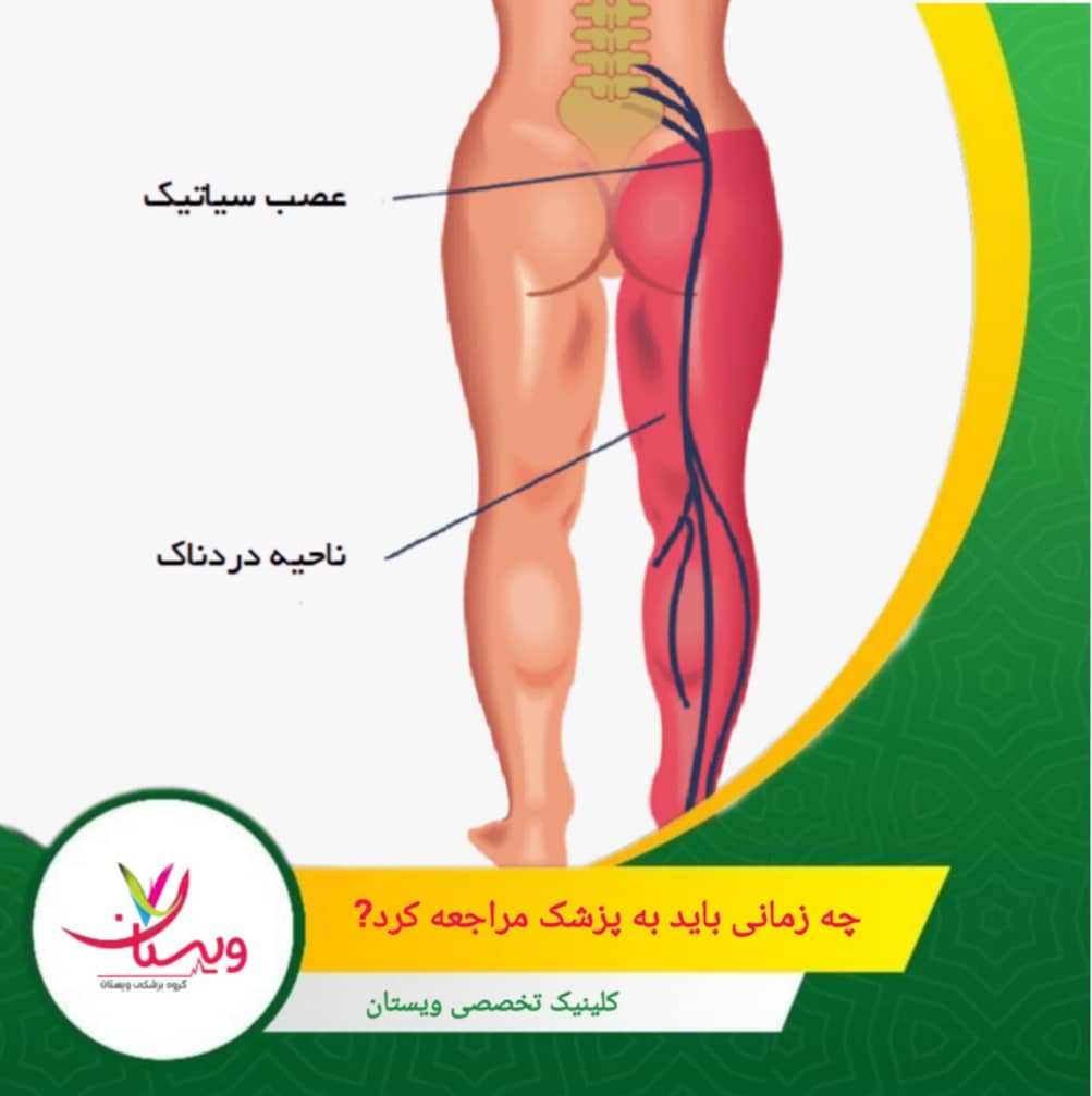اگر درد شما به مدت بیش از دو هفته ادامه پیدا کرد و با درمانهای خانگی بهتر نشد، حتما باید به متخصص مراجعه کنید. چه زمانی باید به پزشک مراجعه کرد؟
