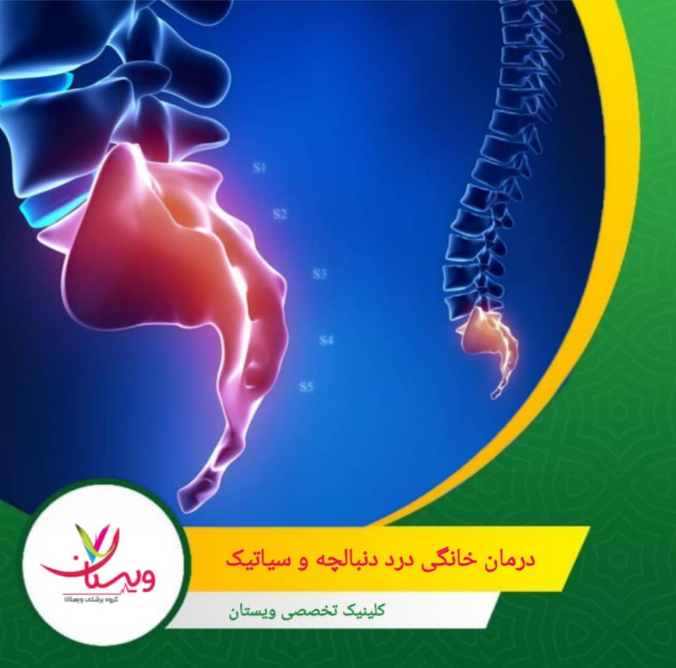 استفاده از صندلی و تشک مناسب برای کاهش فشار روی کمر و عصب سیاتیک درمان خانگی درد دنبالچه و سیاتیک