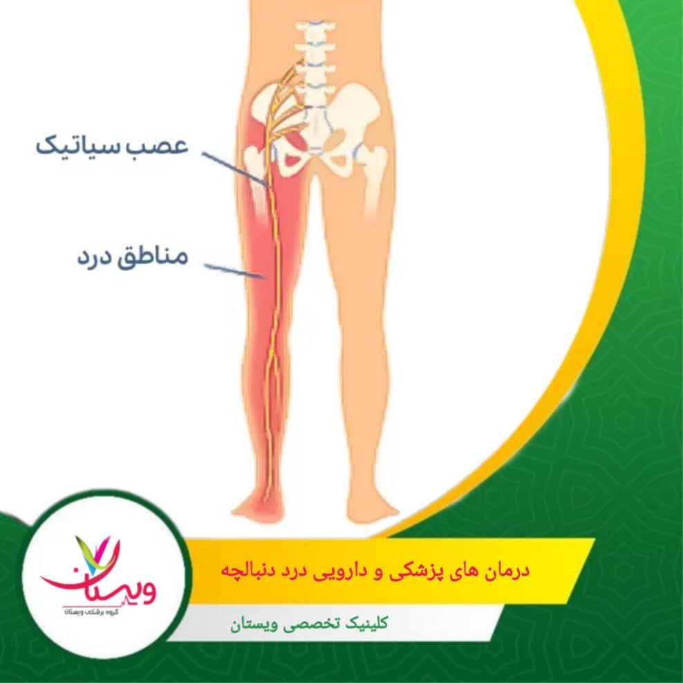 جراحی: در موارد شدید مانند فتق دیسک یا فشار شدید بر عصب، برای رفع مشکل ساختاری درمانهای پزشکی و دارویی درد دنبالچه و سیاتیک