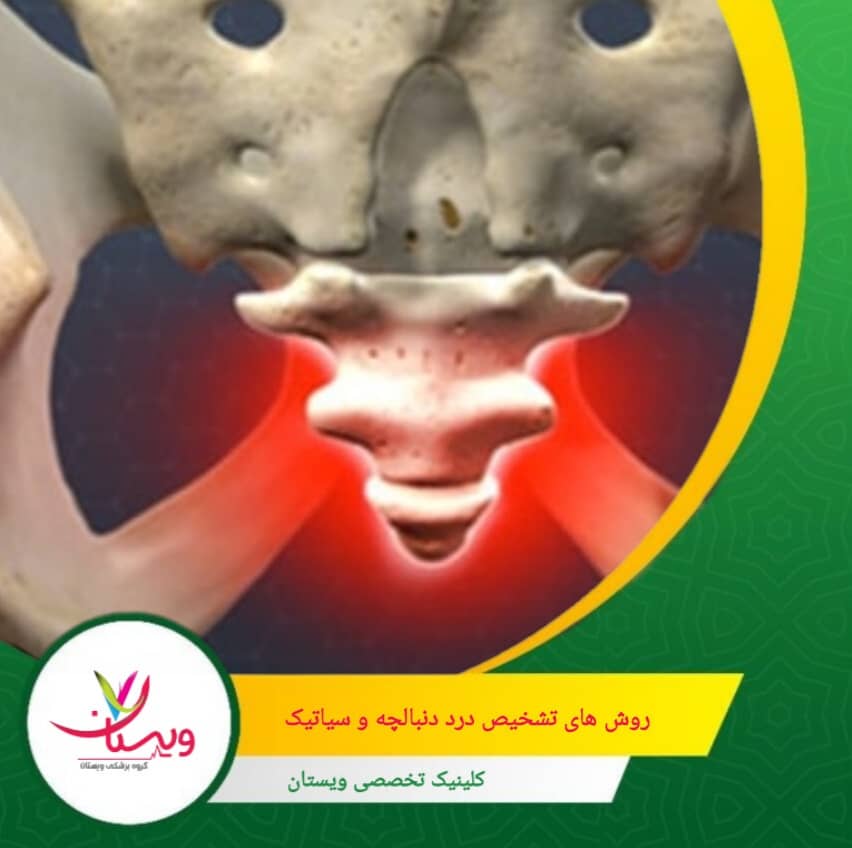 MRI بهترین روش برای دیدن دیسکهای بین مهرهای و فشار روی عصب سیاتیک است. روشهای تشخیص درد دنبالچه و سیاتیک