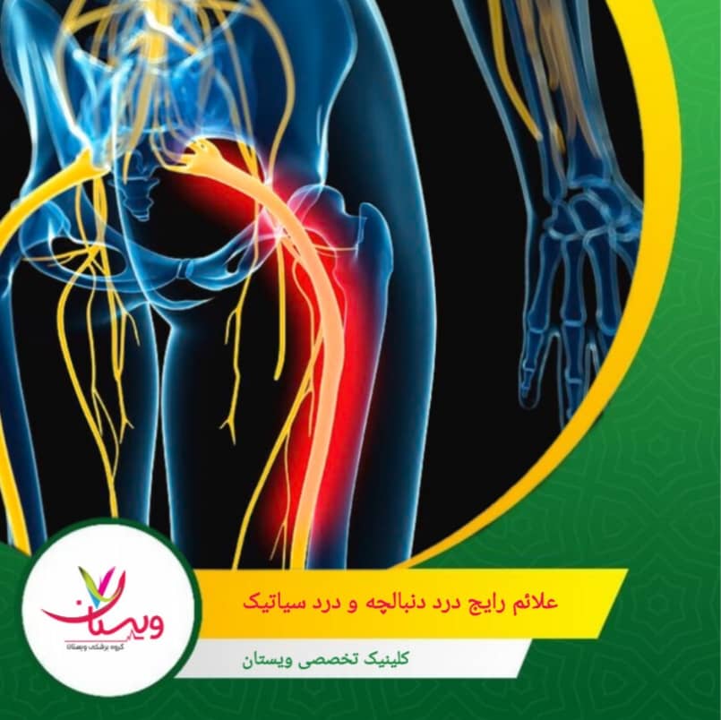 درد سیاتیک ممکن است همراه با کاهش کنترل مثانه یا روده (در موارد شدید) باشد. علائم رایج درد دنبالچه و درد سیاتیک