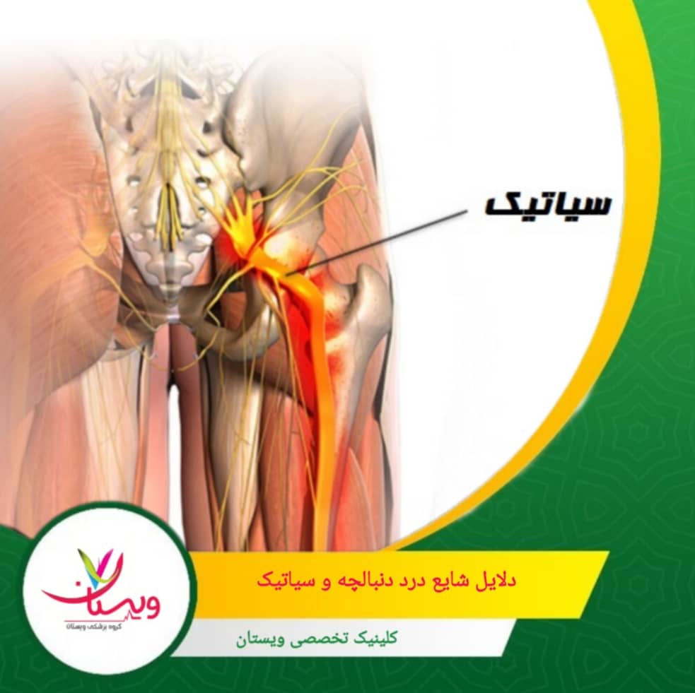 نشستن طولانی مدت و مکرر روی سطوح سخت از دلایل درد دنبالچه می باشد. دلایل شایع درد دنبالچه و سیاتیک