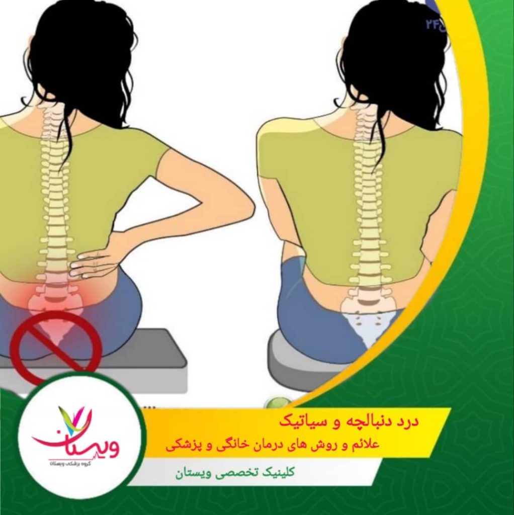 درد دنبالچه و سیاتیک | علائم و روشهای درمان خانگی و پزشکی