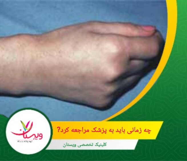 درد هنگام فعالیتهای روزمره مثل تایپ، نگه داشتن اشیاء یا استفاده از موبایل. چه زمانی باید به پزشک مراجعه کرد؟