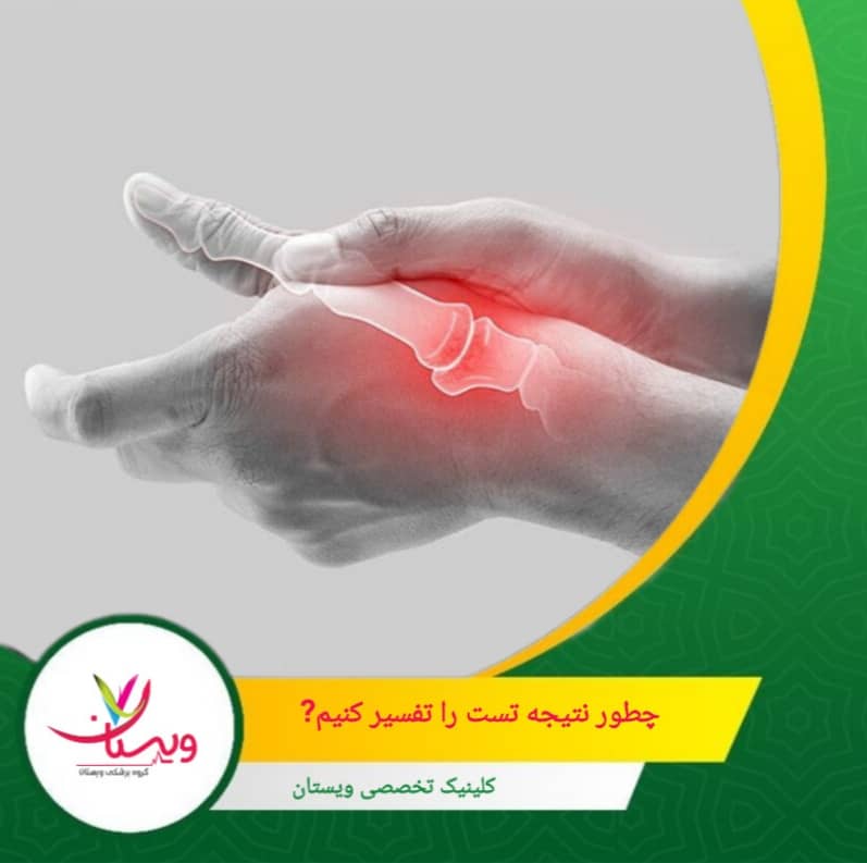 گاهی درد خفیف ممکن است ناشی از عضلات یا مفاصل دیگر مچ باشد؛ بنابراین ترکیب تست دکرون با معاینات تکمیلی، دقت تشخیص را افزایش میدهد. چطور نتیجه تست را تفسیر کنیم؟