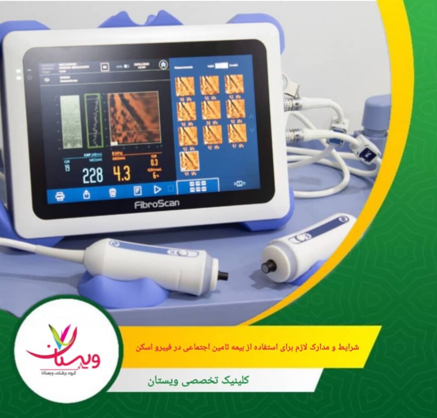 برای استفاده از پوشش بیمه، باید به کلینیکها یا بیمارستانهایی بروید که با تأمین اجتماعی قرارداد فعال دارند. شرایط و مدارک لازم برای استفاده از بیمه تأمین اجتماعی در فیبرو اسکن