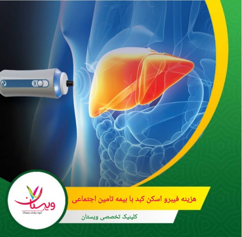هزینه فیبرو اسکن کبد با بیمه تأمین اجتماعی در سال ۱۴۰۴ بسته به نوع مرکز درمانی، کیفیت تجهیزات و میزان پوشش بیمه متفاوت است. هزینه فیبرو اسکن کبد با بیمه تأمین اجتماعی چقدر است؟