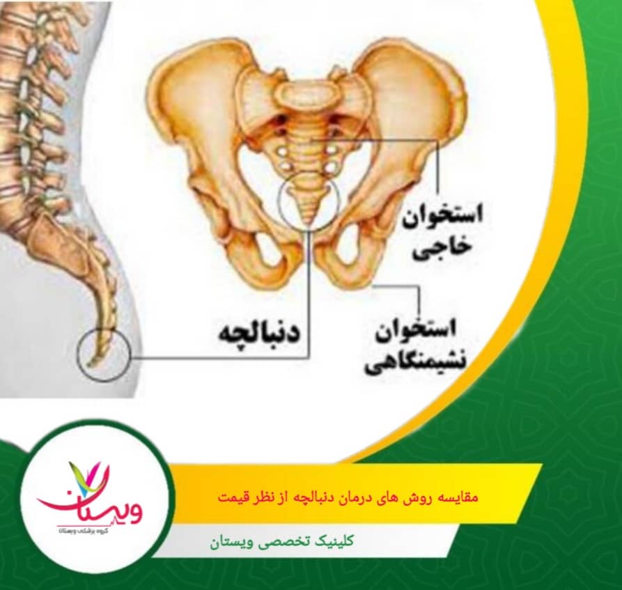 تزریق داروهای داخل مفصلی، معمولاً همراه با جا انداختن یا برای کاهش درد مزمن به کار میرود. مقایسه روشهای درمان دنبالچه از نظر قیمت