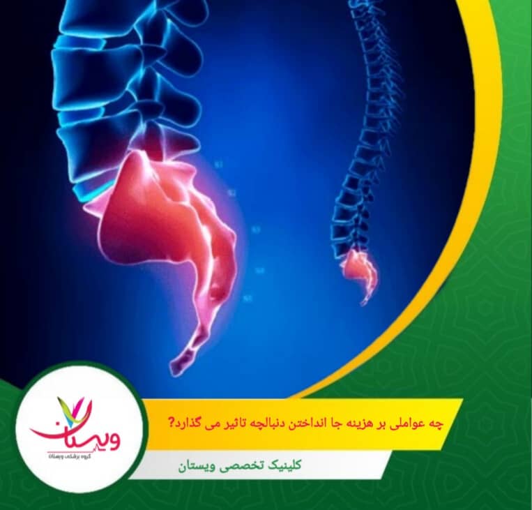 درصدی که بیمه پایه یا تکمیلی تقبل میکند، سهم پرداختی بیمار را به طور قابل توجهی کاهش میدهد. چه عواملی بر هزینه جا انداختن دنبالچه تأثیر میگذارد؟