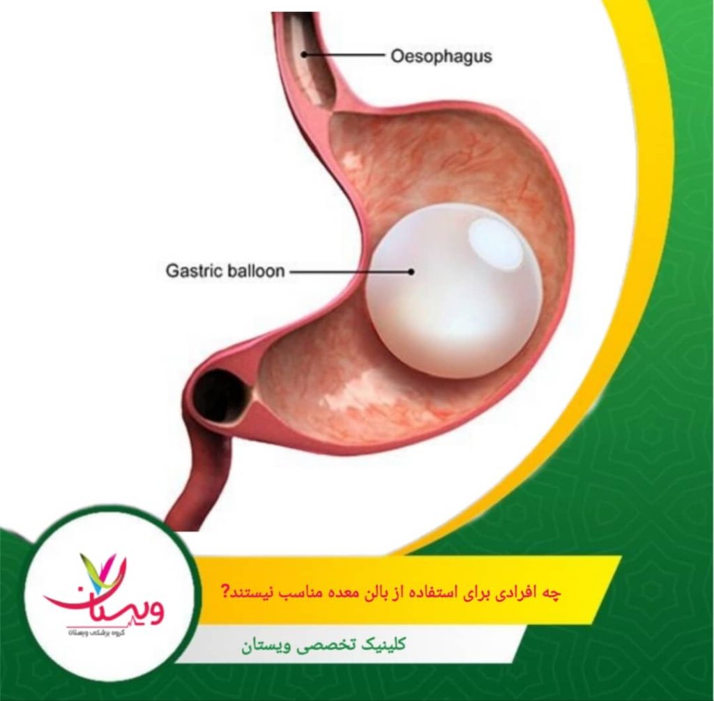 مصرف داروهای ضدانعقاد یا مشکلات خونریزی میتواند خطر عوارض جراحی یا بالن را بالا ببرد. چه افرادی برای استفاده از بالن معده مناسب نیستند؟