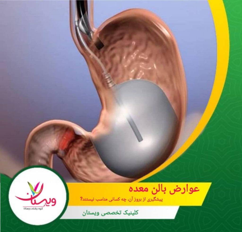 عوارض بالن معده| پیشگیری از بروز آن، چه کسانی مناسب نیستند؟