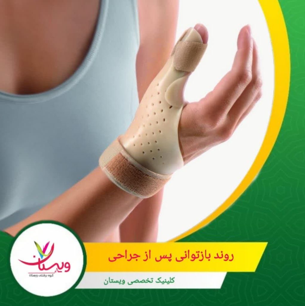 بیشتر بیماران قادرند فعالیتهای روزمره را بدون محدودیت انجام دهند. تمرینات تقویتی پیشرفته و حرکات مقاومتی به بازتوانی کامل کمک میکند. روند بازتوانی پس از جراحی