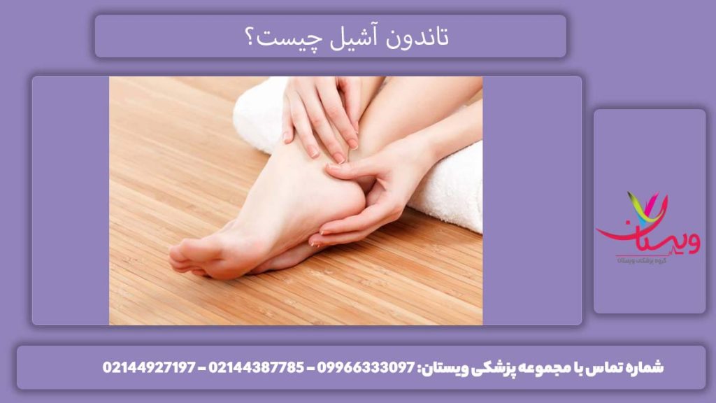 تاندون پشت پا بررسی پارگی تاندون آشیل پا