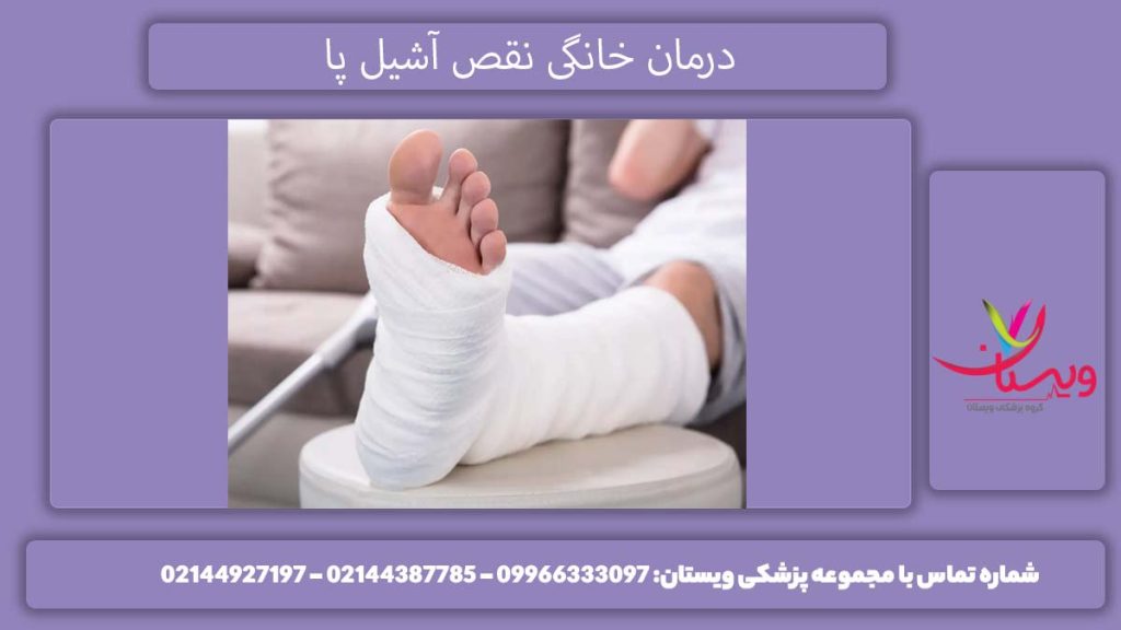 روشهای درمانی زردپی آشیل در منزل درمان خانگی نقص آشیل پا