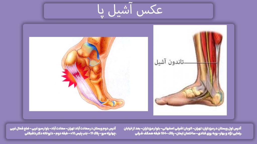 تصویر زردپی پشت پا تصویر ساختار عضله پشت ساق پا