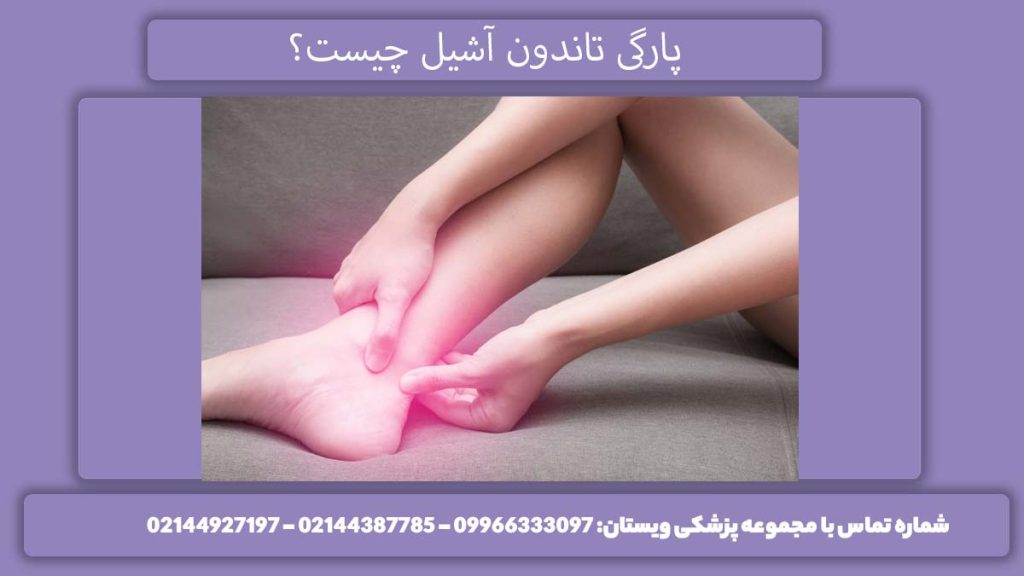 پارگی تاندون آشیل پا چیست؟