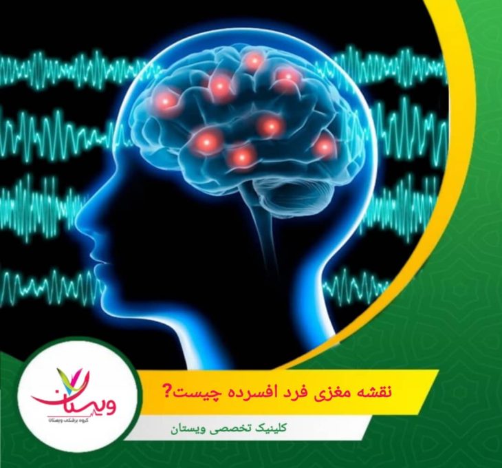 یکی از ویژگیهای برجسته QEEG، توانایی آن در مقایسه فعالیت مغزی فرد با دادههای نرمال است. نقشه مغزی فرد افسرده چیست؟