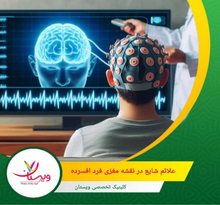 کاهش فعالیت امواج آلفا (۸–۱۲ هرتز) در نواحی پیشانی مغز که میتواند نشاندهنده اختلال در تنظیم عاطفی و کاهش توانایی در آرامش و استراحت باشد. علائم شایع در نقشه مغزی فرد افسرده