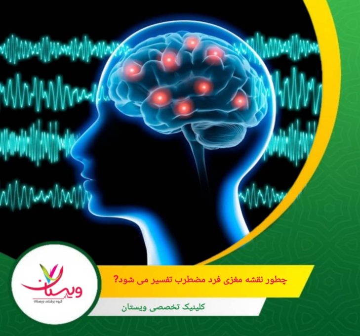 تفسیر نقشهمغزی به صورت بصری نیز ارائه میشود؛ نمودارها و نقشههای رنگی به متخصص کمک میکنند تا الگوهای فعالیت مغز را به سرعت و به وضوح درک کند. چطور نقشه مغزی فرد مضطرب تفسیر میشود؟