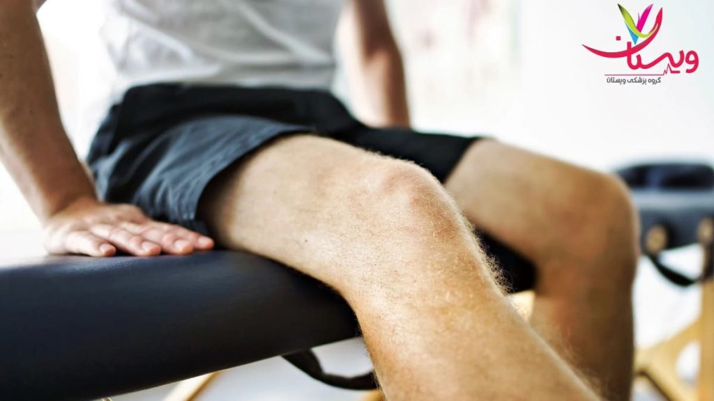 بهبود حرکت زانو با تمرینات توانبخشی درمان آرتروز زانو با هومیوپاتی و تمرینات توانبخشی