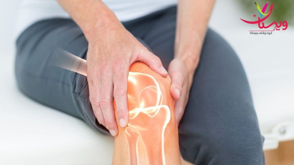 مشکلات مفصلی در اثر آرتروز زانو التهاب مفصل زانو و مشکلات حرکتی ناشی از آرتروز