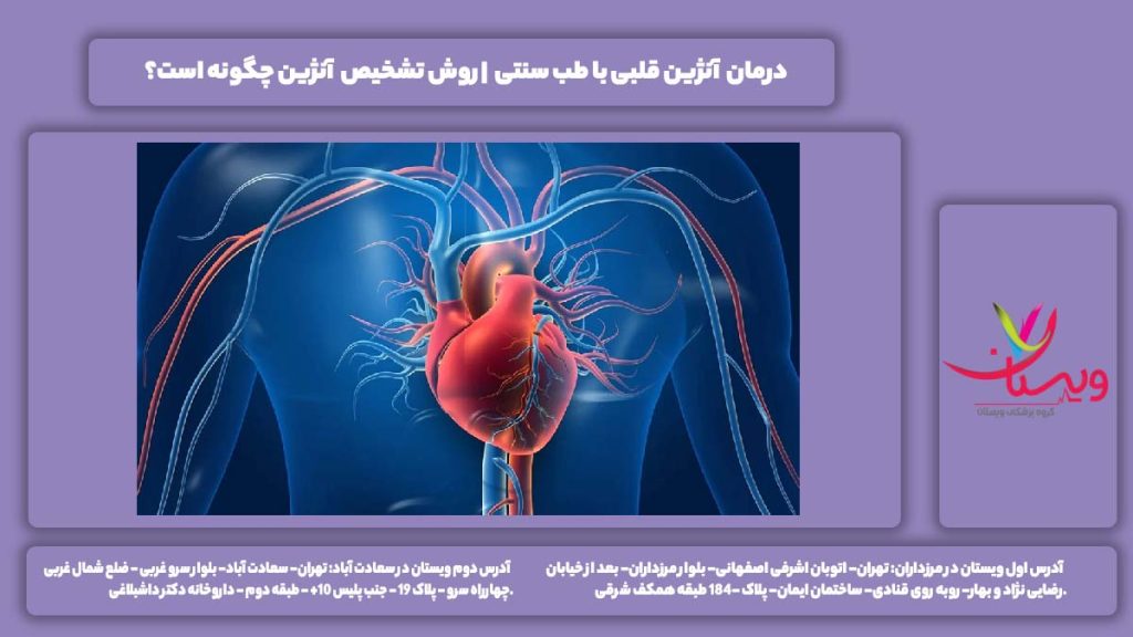 درمان آنژین قلبی