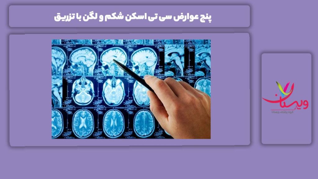 ضررهای سی تی اسکن شکم و لگن با تزریق 5 عوارض سی تی اسکن شکم و لگن با تزریق