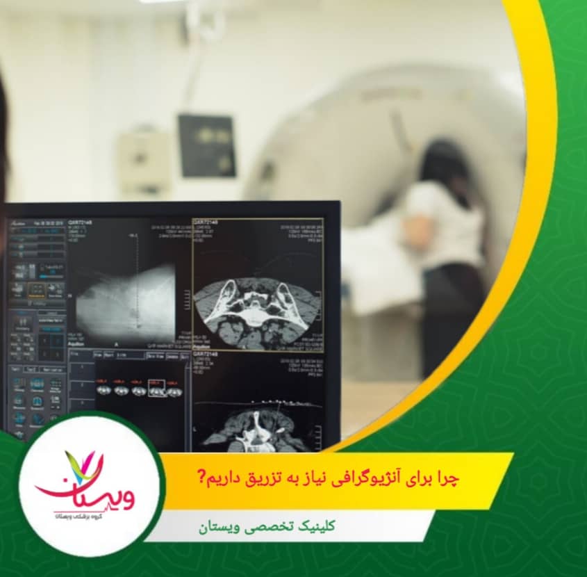 ایجاد تصاویر سهبعدی دقیق: کمک به برنامهریزی جراحی و درمانهای مداخلهای. چرا برای آنژیوگرافی نیاز به تزریق داریم؟