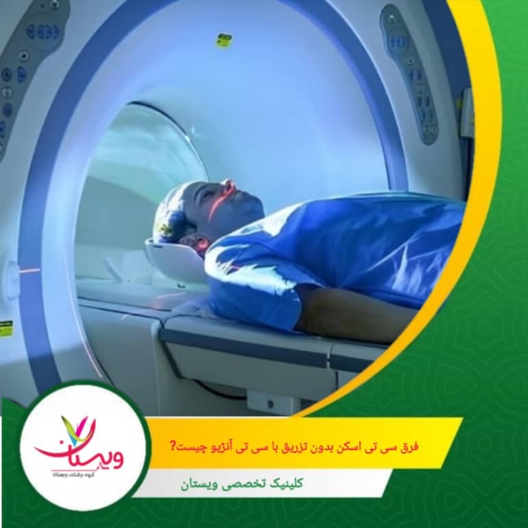 فرق سیتی اسکن بدون تزریق با سیتی آنژیو چیست؟