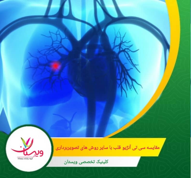 سی تی آنژِو قلب کوتاه و معمولاً کمتر از ۳۰ دقیقه است. مقایسه سی تی آنژیو قلب با سایر روشهای تصویربرداری