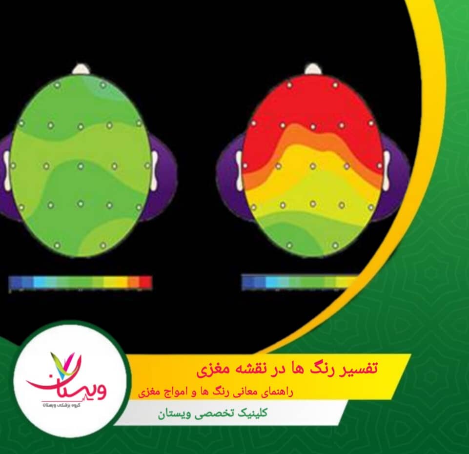 تفسیر رنگها در نقشه مغزی| راهنمای معانی رنگها و امواج مغزی