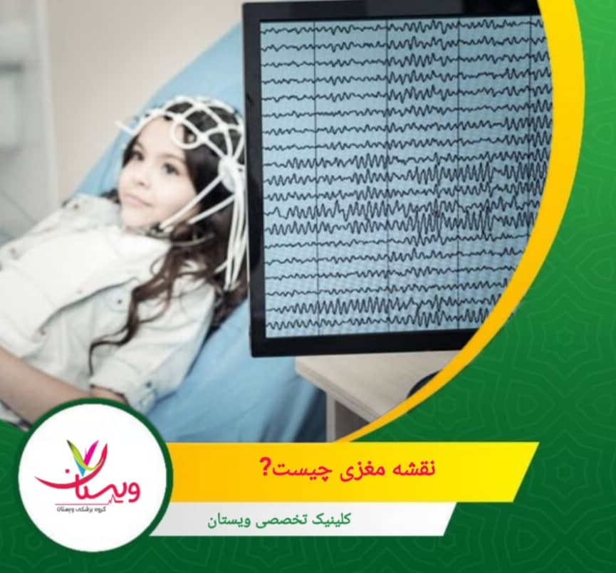 امواج مغزی شامل انواع مختلفی مثل دلتا، تتا، آلفا، بتا و گاما هستند؛ هر کدام با حالات ذهنی متفاوتی ارتباط دارند. نقشه مغزی قدرت و توزیع این امواج را بررسی میکند. نقشه مغزی چیست؟