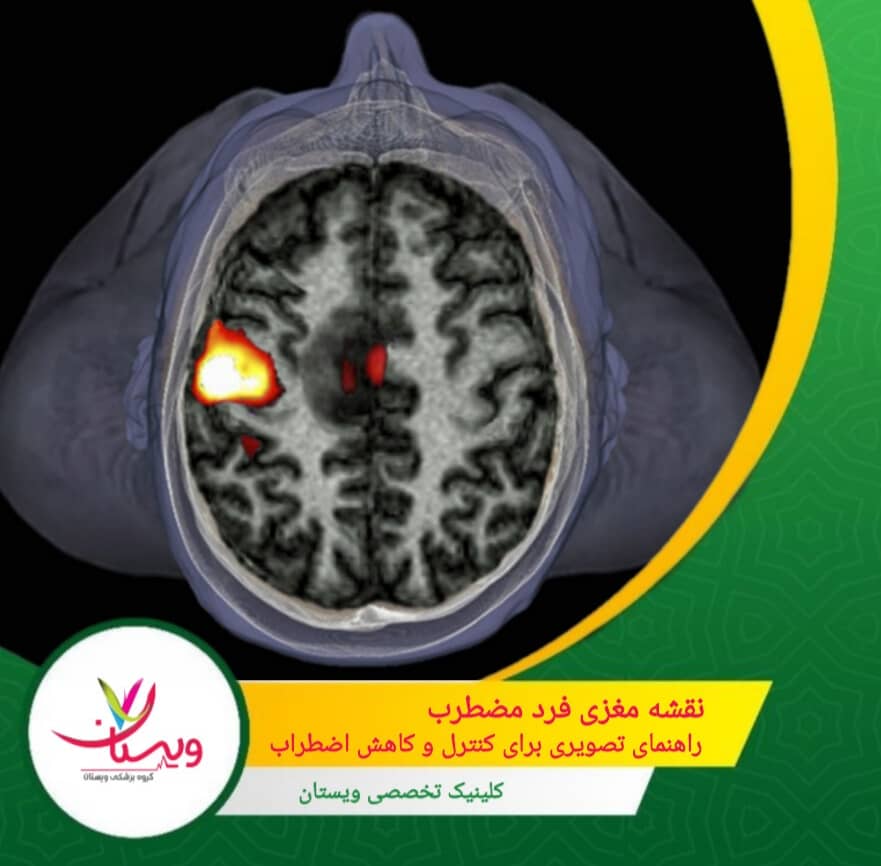 نقشه مغزی فرد مضطرب: راهنمای تصویری برای کنترل و کاهش اضطراب