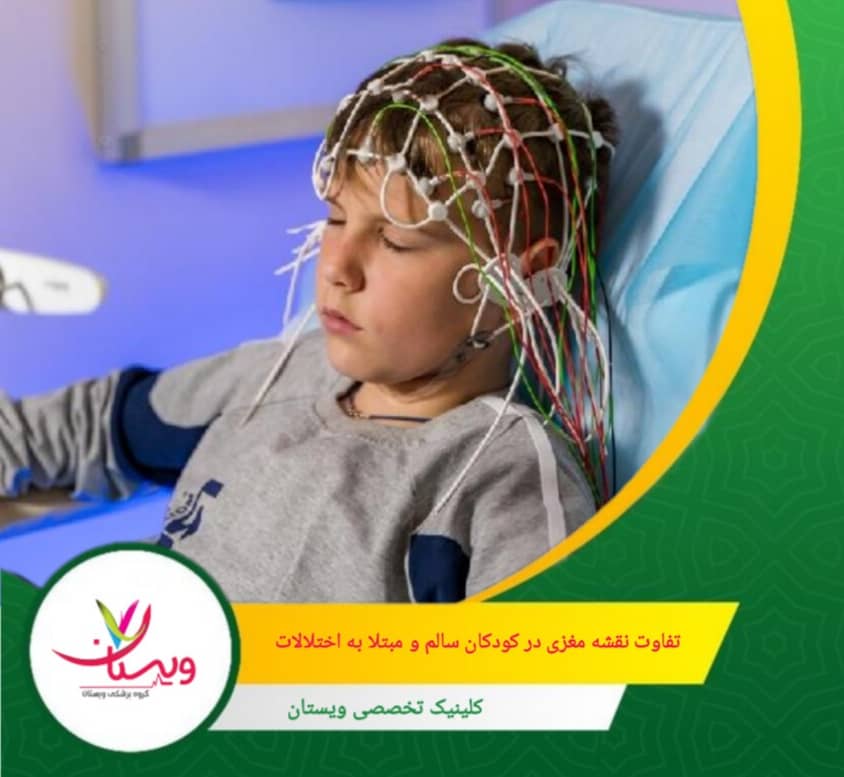 برخی کودکان ممکن است عدم تعادل در فعالیت نواحی مربوط به حافظه، بینایی یا پردازش اطلاعات نشان دهند. تفاوتهای نقشه مغزی در کودکان سالم و مبتلا به اختلالات