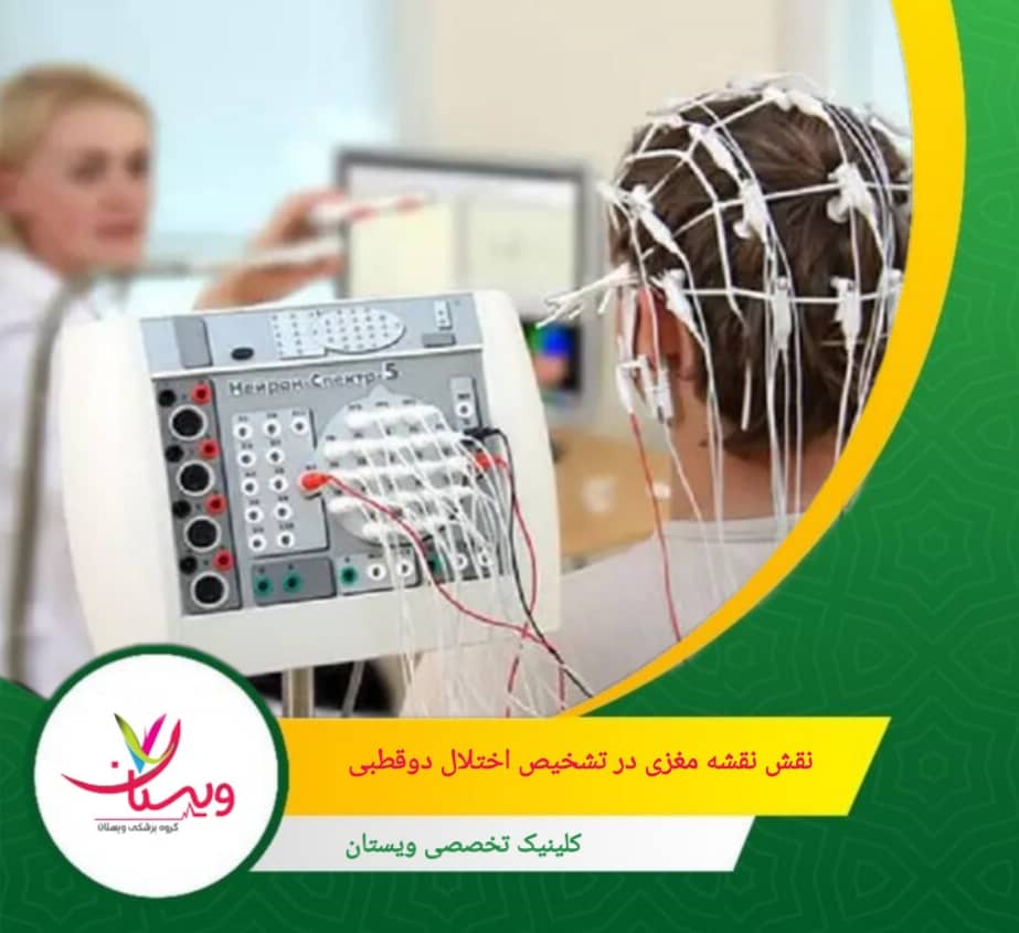 نقش نقشه مغزی در تشخیص اختلال دو قطبی