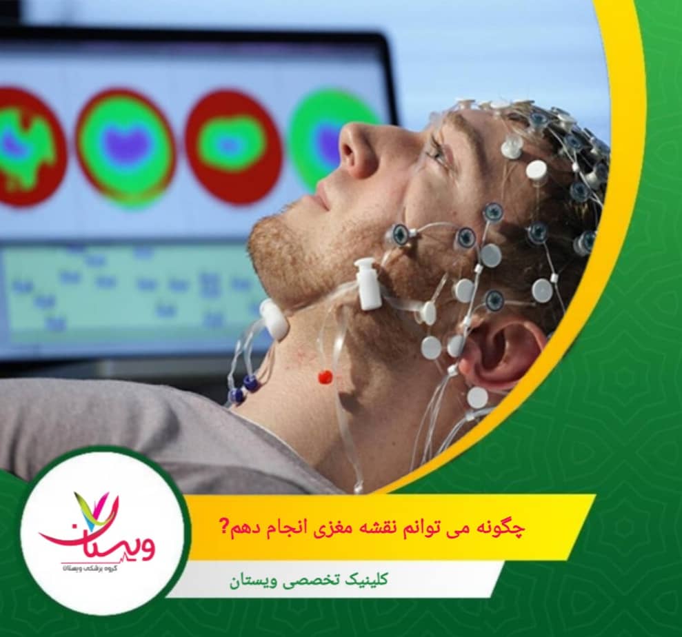 چگونه میتوانم نقشه مغزی انجام دهم؟